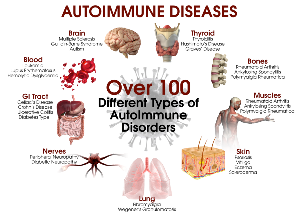 Autoimmune Disorders That Cause Muscle And Joint Pain